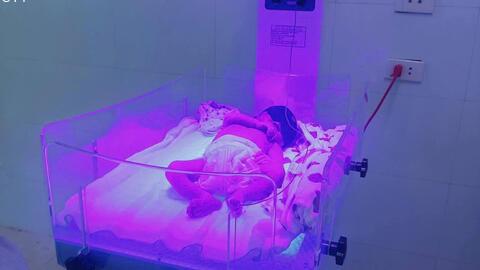 VÀNG DA SƠ SINH: KHI NÀO LÀ BÌNH THƯỜNG, KHI NÀO CẦN CHIẾU ĐÈN?